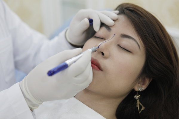 Nâng mũi bao lâu thì hết sưng và đẹp tự nhiên?