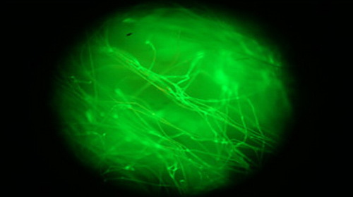  Tằm biến đổi gene sản xuất tơ nhân tạo 