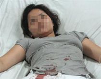 Sắt dàn giáo rơi vào người đi đường từ độ cao 20 mét 